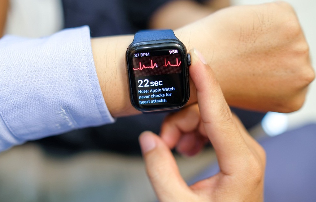 Smart Watch Apple Serie5 GPS 40mm  viÃªÌn nhÃ´m VÃ ng dÃ¢y cao su HÃ´Ìng